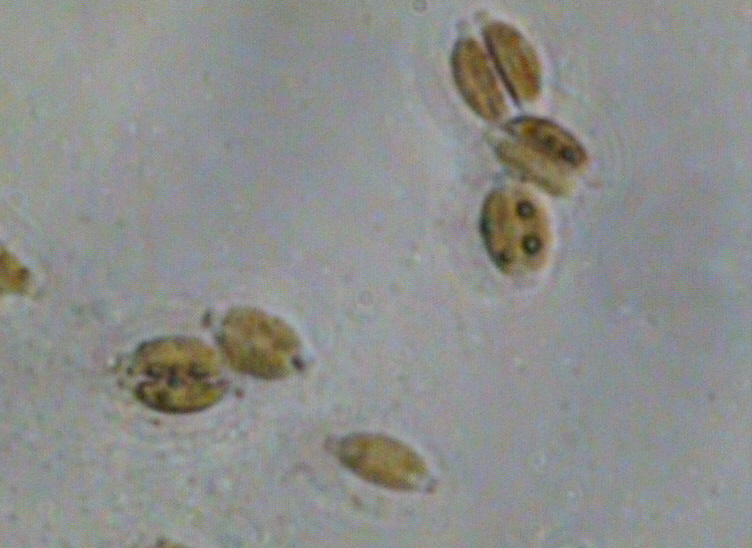 Dictyocha speculum